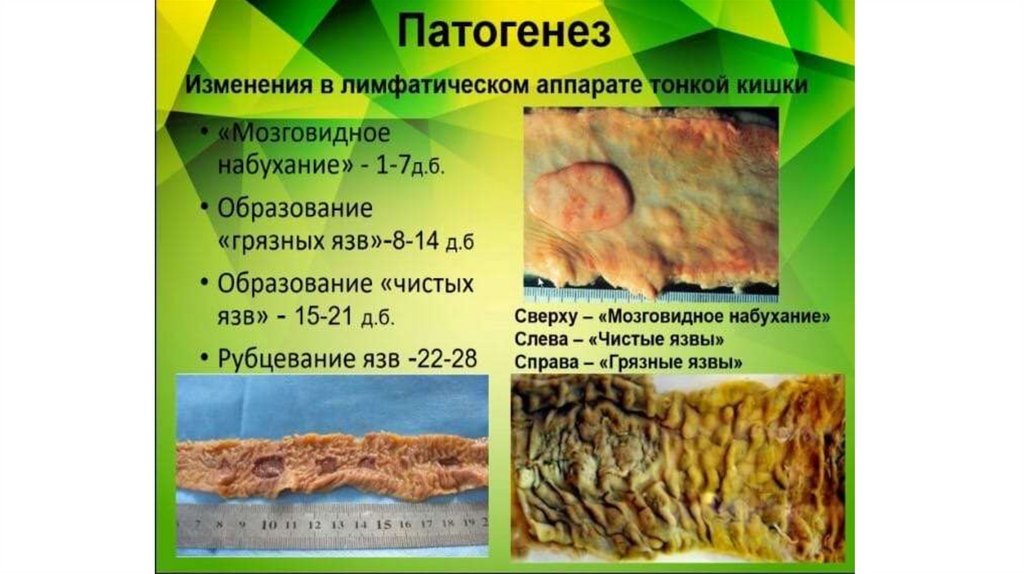 Брюшной тиф - презентация онлайн
