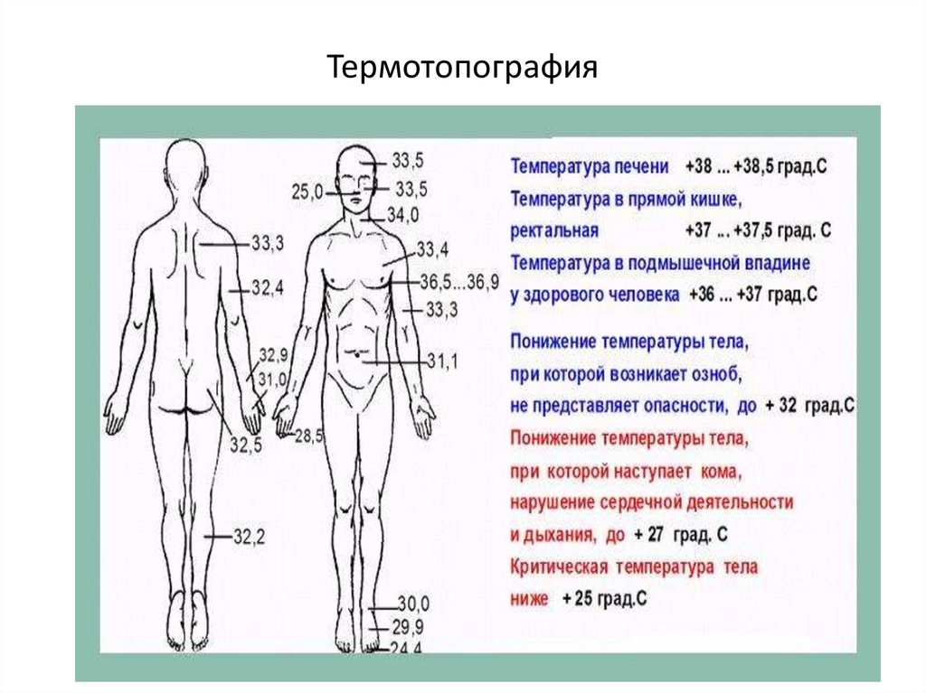 Термотопография