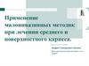 Применение малоинвазивных методик при лечении среднего и поверхностного кариеса