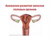 Аномалии развития женских половых органов