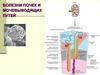 Болезни почек и мочевыводящих путей