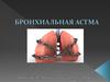 Бронхиальная астма