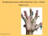 Инфекционные заболевания как с ними бороться