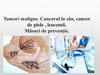 Tumori maligne. Cancerul la sân, cancer de piele, leucemii