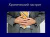 Хронический гастрит