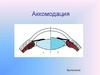 Аккомодация