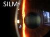 Silm