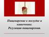 Пищеварение в желудке и кишечнике. Регуляция пищеварения