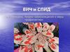 ВИЧ и СПИД