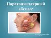 Паратонзиллярный абсцесс. Введение