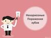 Некариозные поражения зубов