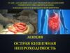 Острая кишечная непроходимость
