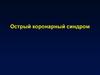 Острый коронарный синдром