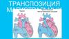 Транспозиция магистральных сосудов