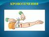 Кровотечения. Классификация