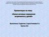 Какие речевые нарушения встречаются у детей