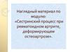 Сестринский процесс при ревматоидном артрите, деформирующем остеоартрозе