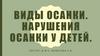 Виды осанки. Нарушения осанки у детей