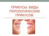 Прикусы. Виды патологических прикусов