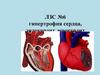 Гипертрофия сердца, эндокардит, миокардит. ЛЗС №6