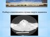 Разбор клинического случая смерти пациента