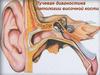 Лучевая диагностика патологии височной кости