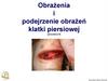Obrażenia i podejrzenie obrażeń klatki piersiowej (procedura 9)
