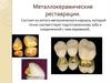 Металлокерамические реставрации