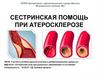 Сестринская помощь при атеросклерозе
