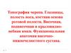 Топография черепа. Глазницы, полость носа, костная основа ротовой полости. Височная, подвисочная и крыловиднонебная ямки