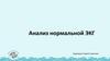Анализ нормальной ЭКГ