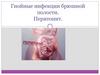 Гнойные инфекции брюшной полости. Перитонит