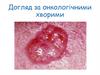 Догляд за онкологічними хворими