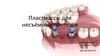 Пластмассы для несъёмных протезов