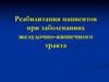 Реабилитация пациентов при заболеваниях желудочно-кишечного тракта