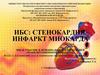 Стенокардия, инфаркт миокарда