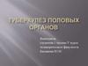 Туберкулез половых органов