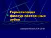 Герметизация фиссур постоянных зубов