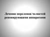 Лечение переломов челюстей репонирующими аппаратами