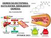 Обмен холестерина. Патология липидного обмена