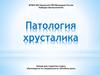 Патология хрусталика