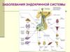 Заболевания эндокринной системы