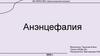 Анэнцефалия. Причины