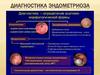 Диагностика эндометриоза