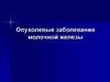 Опухолевые заболевания молочной железы