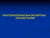 Рентгенологическая экспертиза плоскостопия