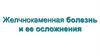 Желчнокаменная болезнь и ее осложнения
