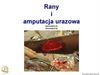 Rany i amputacja urazowa (procedura 5, procedura 6)