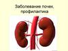 Заболевание почек, профилактика