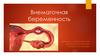 Внематочная беременность
